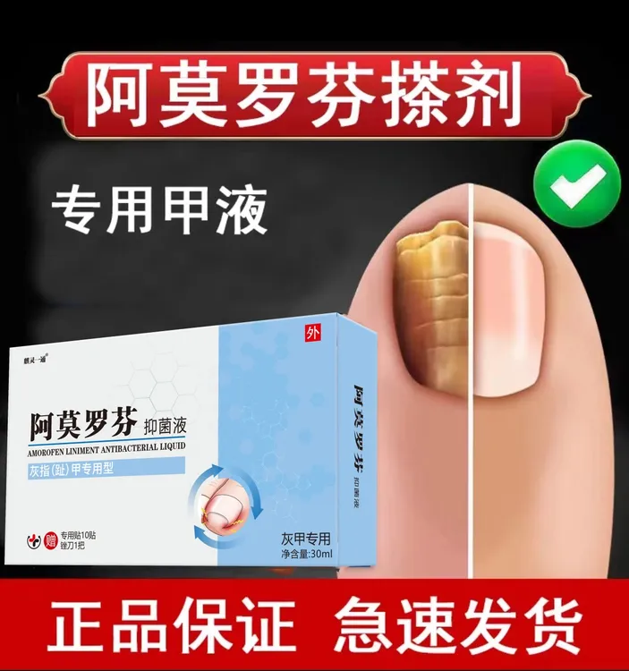 正品阿莫罗芬草本灰趾指甲亮甲风仙花抑菌液去坏软甲修护脚指甲液