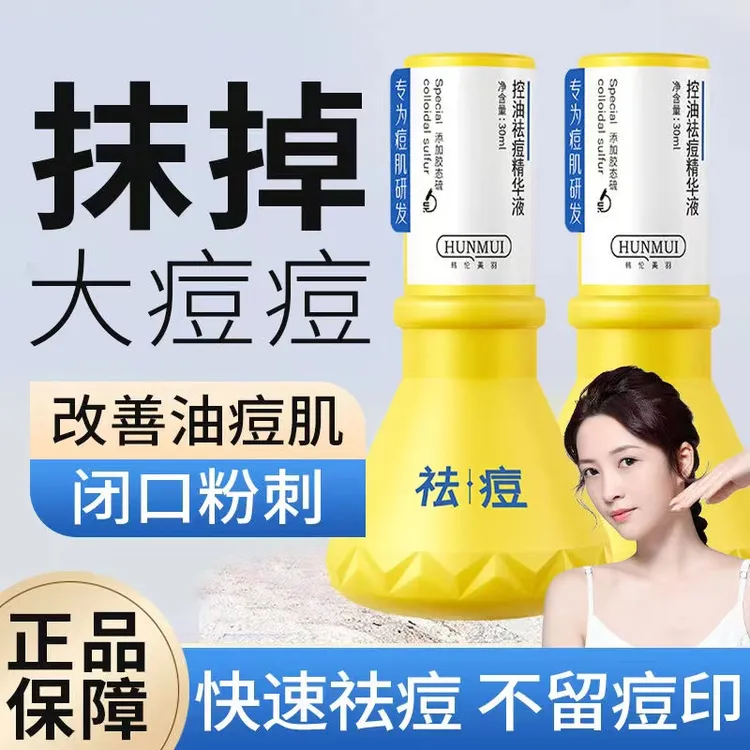 祛痘大灯泡正品精华补水改善祛痘坑祛红痘印黑头粉刺素温和不刺激