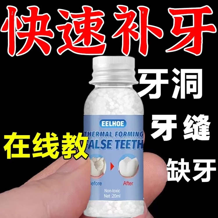补牙齿洞膏补牙缝修复临时可拆卸填牙洞填充剂树脂材料修补牙粉