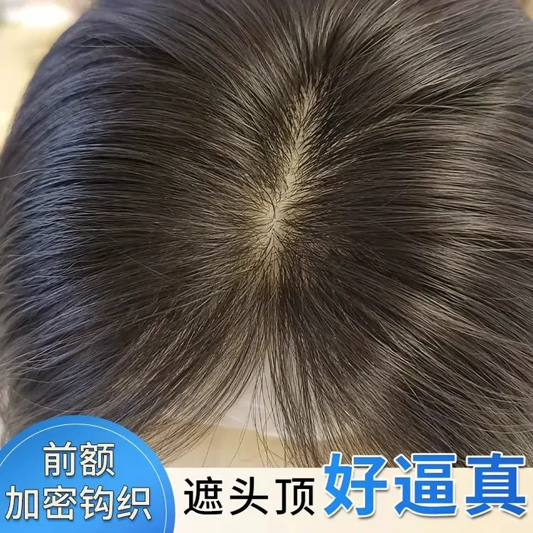 假发女片头顶全真发增发量蓬松遮白发补发片高颅顶夏季薄款假发片