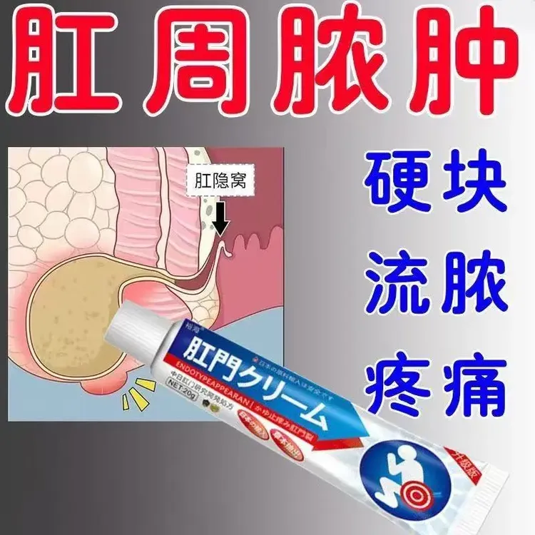 肛周脓肿软膏外用缓解肛瘘封口膏