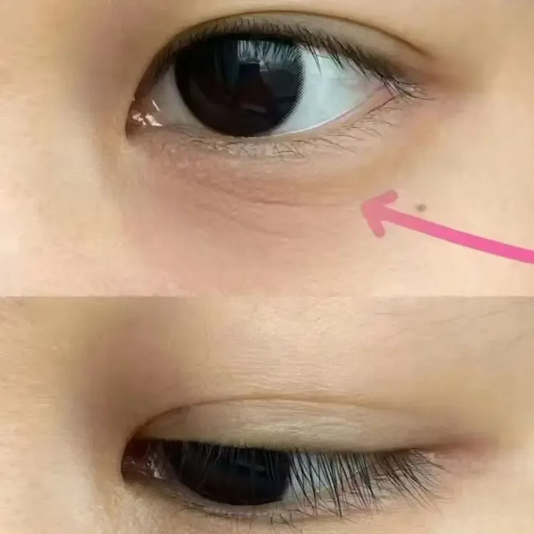 眼周肽胶原水光干纹细纹眼尾细纹黑眼圈