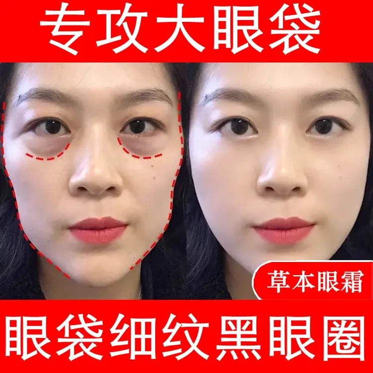 改善眼袋细纹男女士眼部精华油草本眼霜保湿补水淡化黑眼圈神器