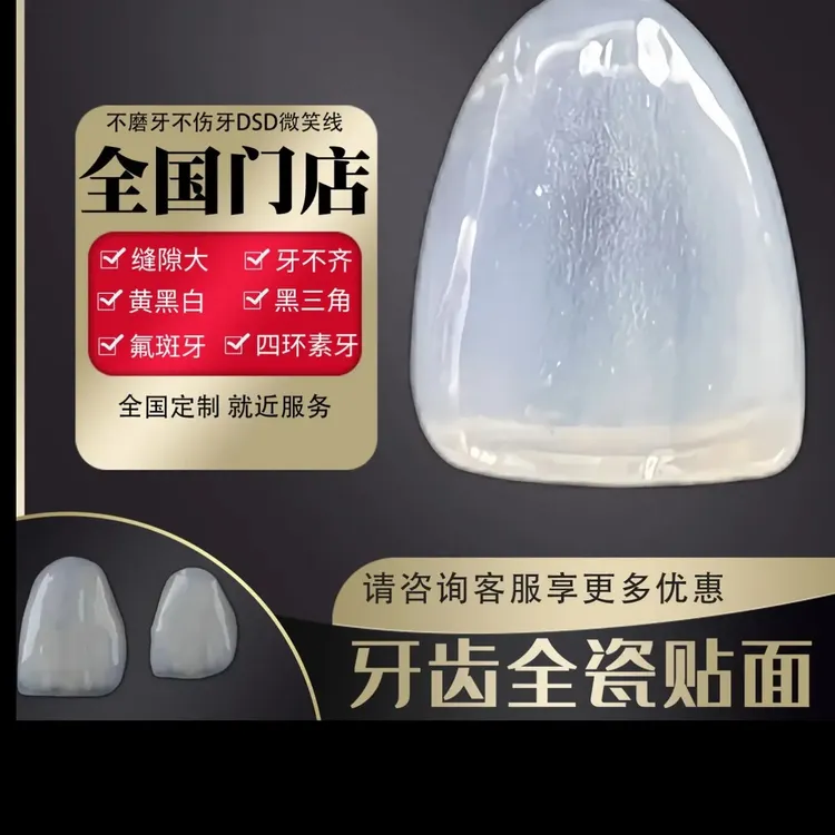 全齿贴面定制美牙修复超薄瓷微笑线设计