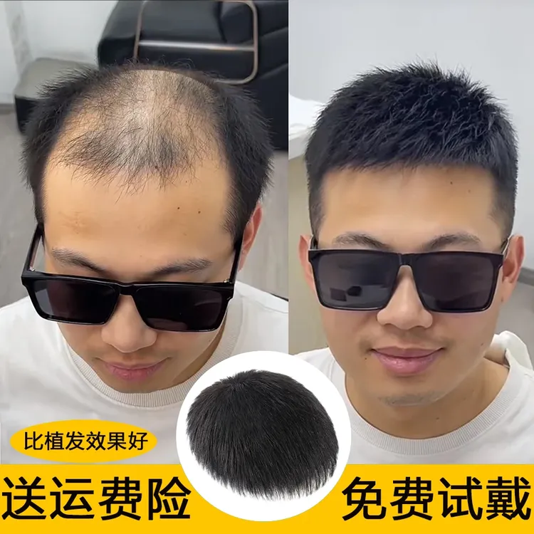新款男士假发遮盖头顶男式假发片隐形自然可粘可卡全真发假发男生