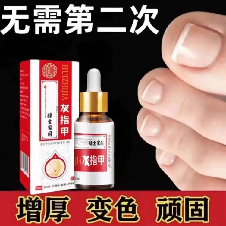 草本灰趾指甲亮甲凤仙花抑菌液去坏软甲修护脚指甲专用