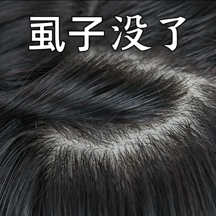 除小女孩头发上的虱子虱卵洗发水儿童大人用除头虱立净百部酊香波