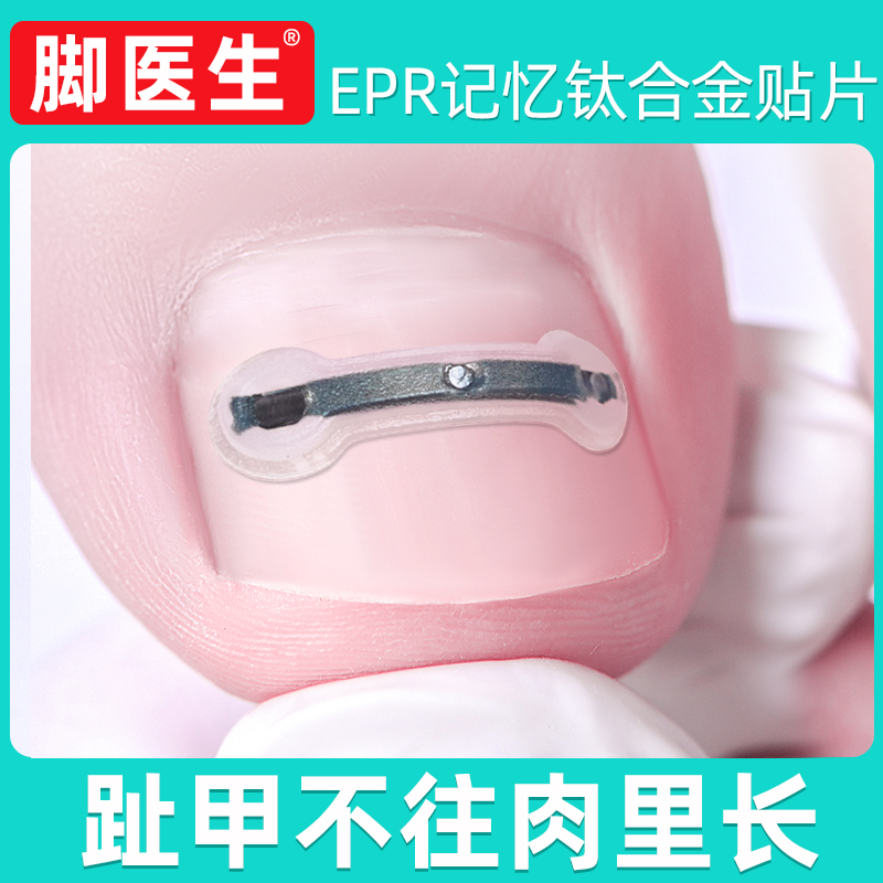 JIAOYISHENG/脚医生足部固定器甲沟嵌甲正甲贴脚趾甲贴片指甲扎肉
