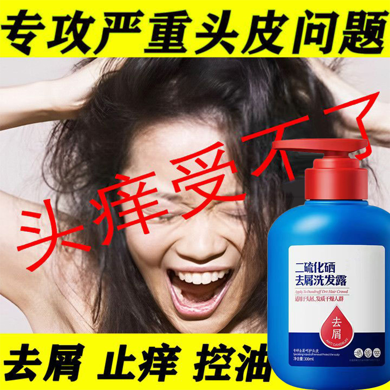 二硫化硒去屑洗发露控油除螨洗头发水清爽蓬松柔顺剂洗头膏男女用