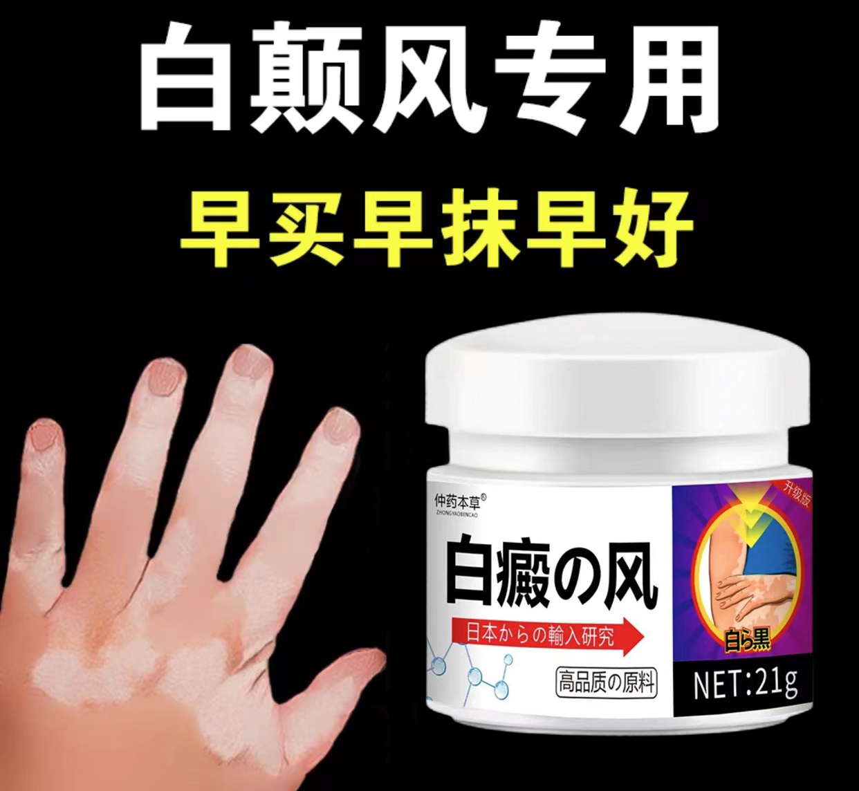 白斑净外用涂抹膏草本温和多部位可用