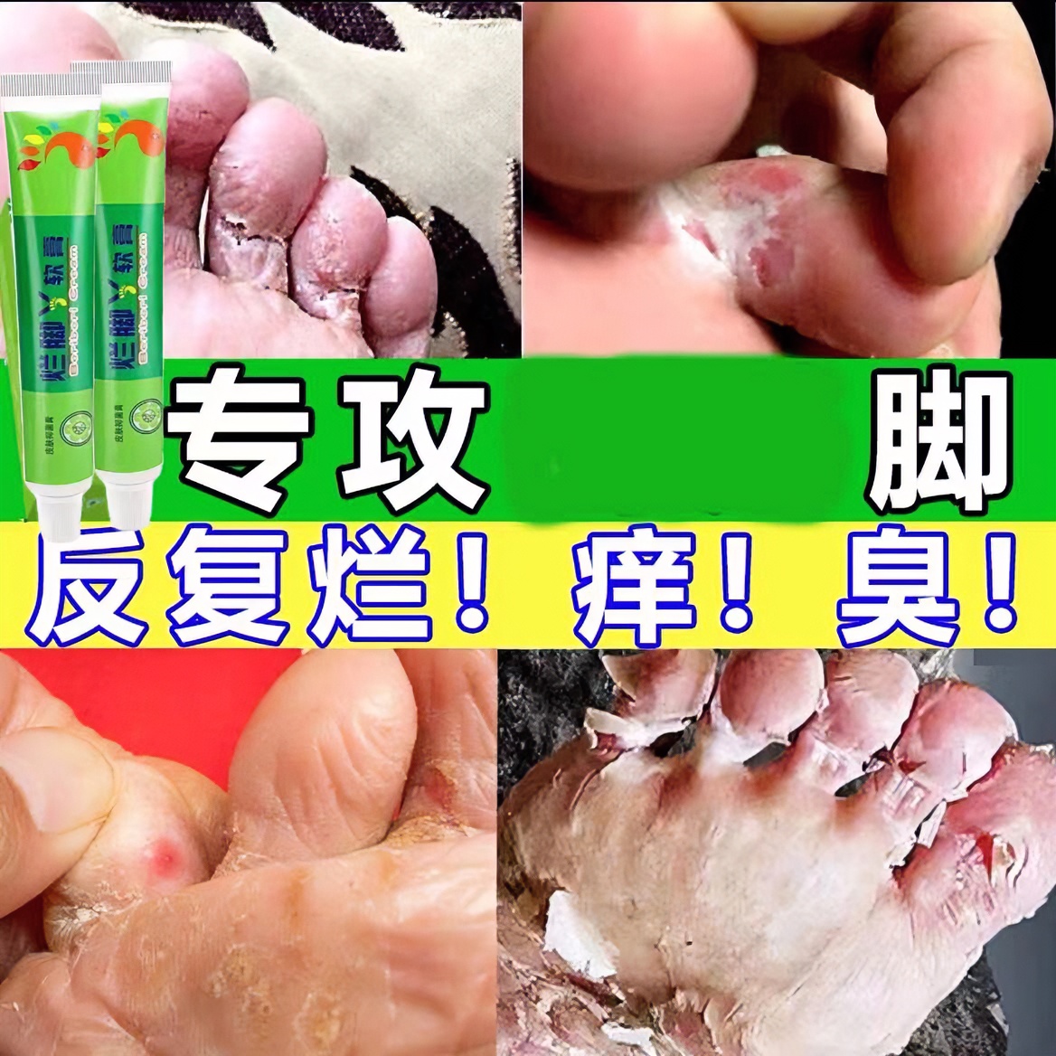 脚痒脚臭脚干裂脱皮脚汗干痒起水·泡脚趾缝止痒抑菌软膏