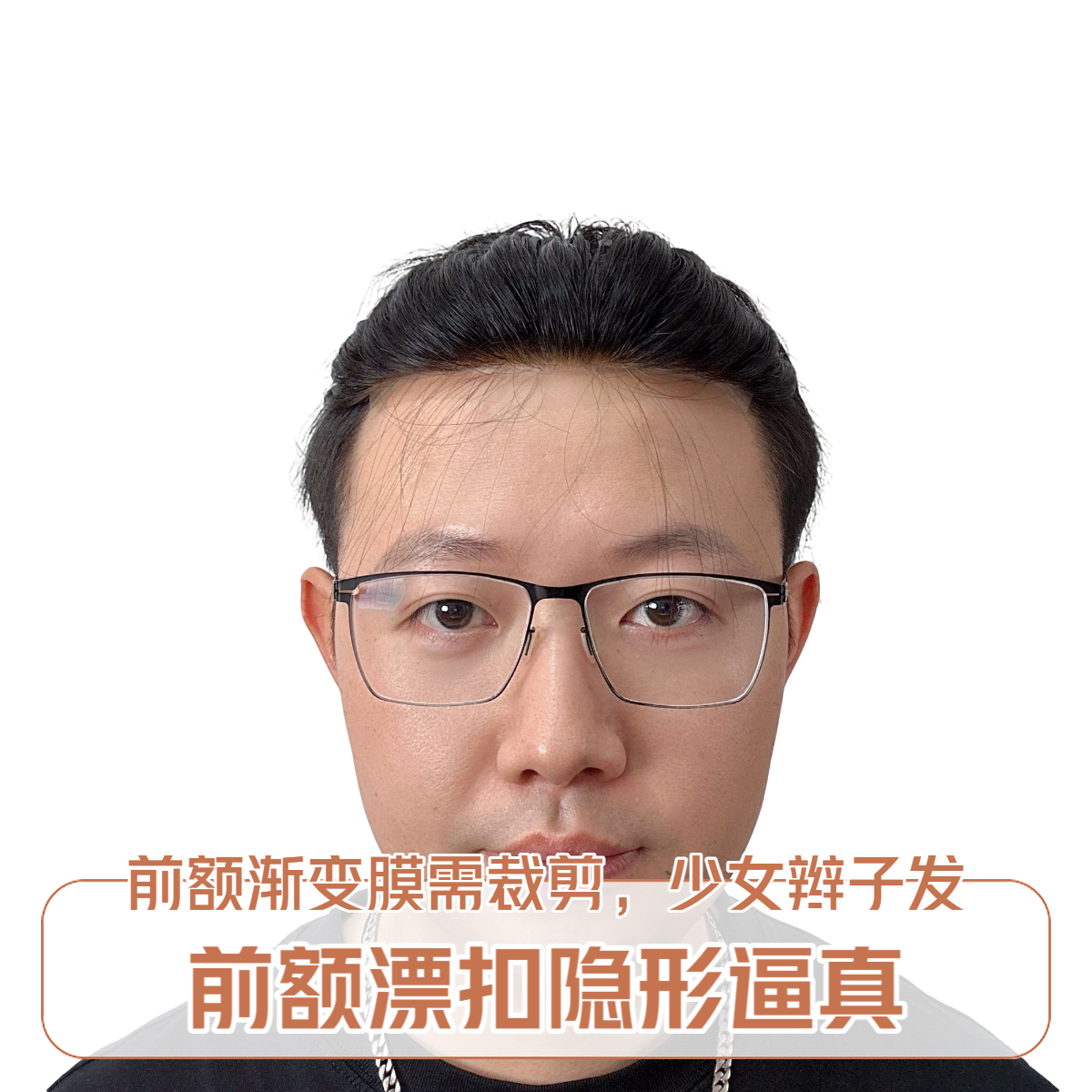 【无忌精选-倚天剑】前额漂扣超薄生物边朝鲜假发钩织辫子发