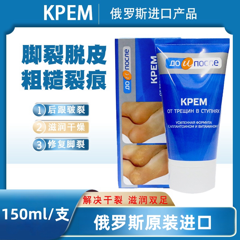 俄罗斯进口至前/至后牌滋养温和保湿护足霜防裂防干修护脚裂膏