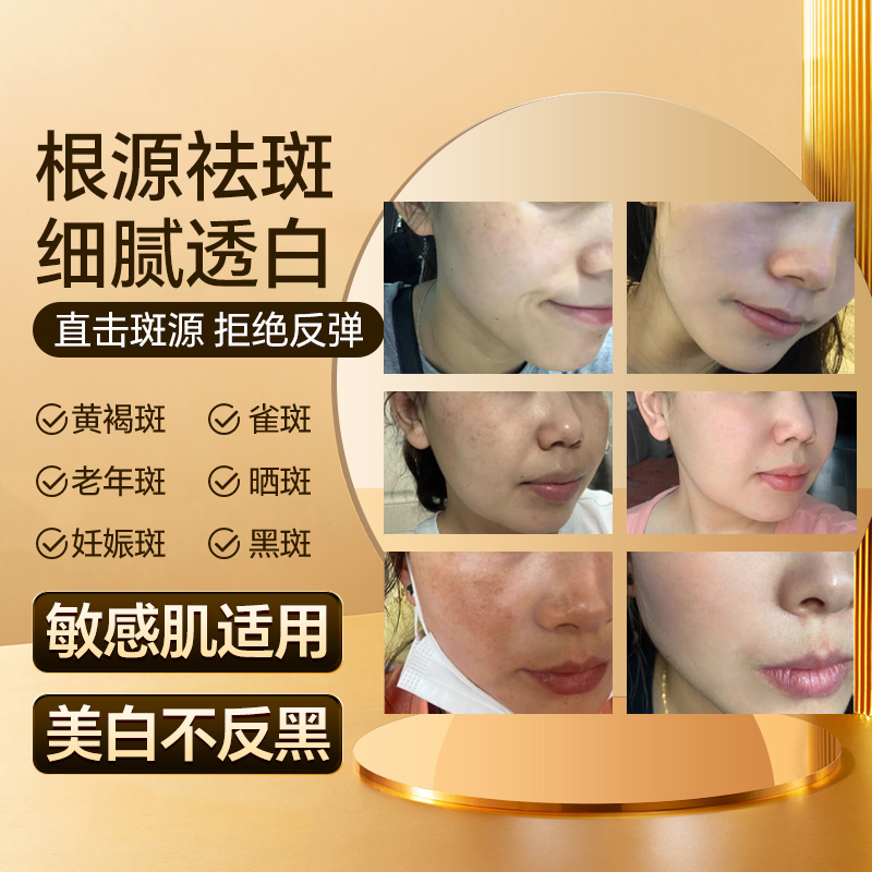 宝藏（拍一发二）JACY6s2祛1班1霜美白精华2024新款梵玥