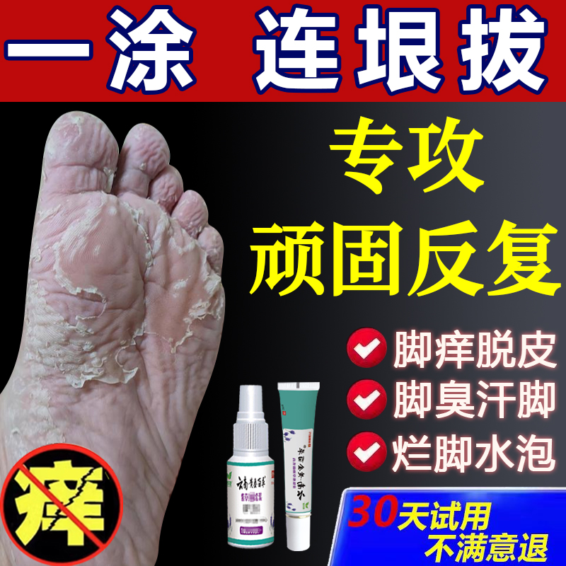 脚止痒脚臭气脱皮水泡脚克星脚底干裂烂脚喷雾剂止痒烂脚神器正品