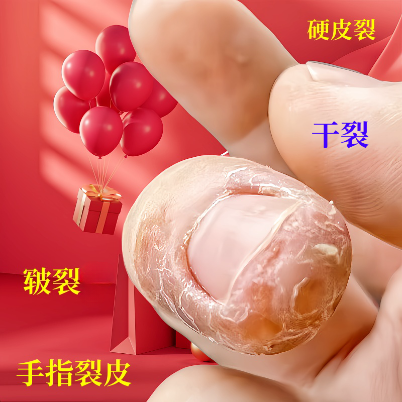手指尖干裂深层起皮修护膏手足干裂皴裂硬皮裂口滋润护理手足干裂