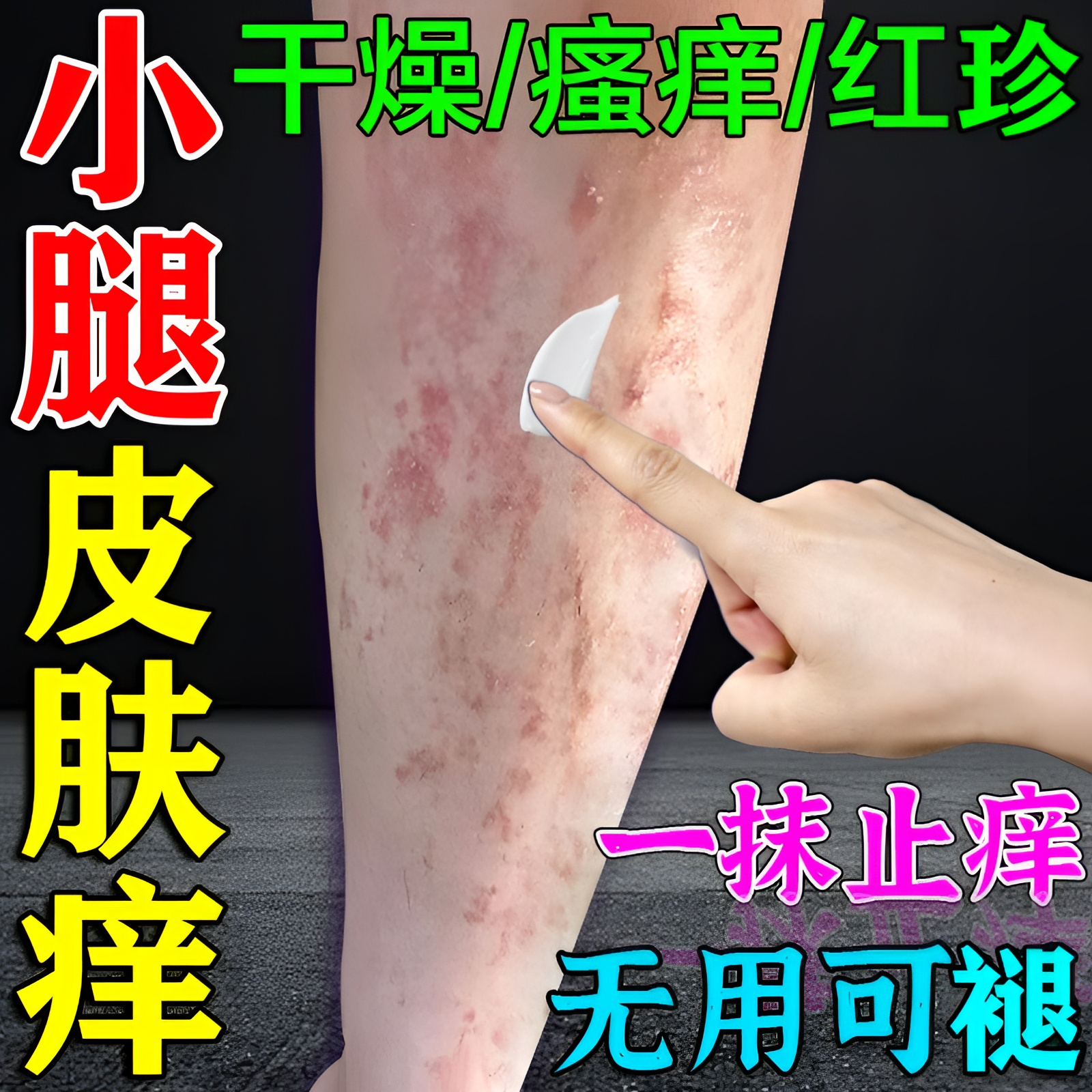 身上皮肤痒秋冬季后背手臂大腿干痒起长小红点温和止痒软膏