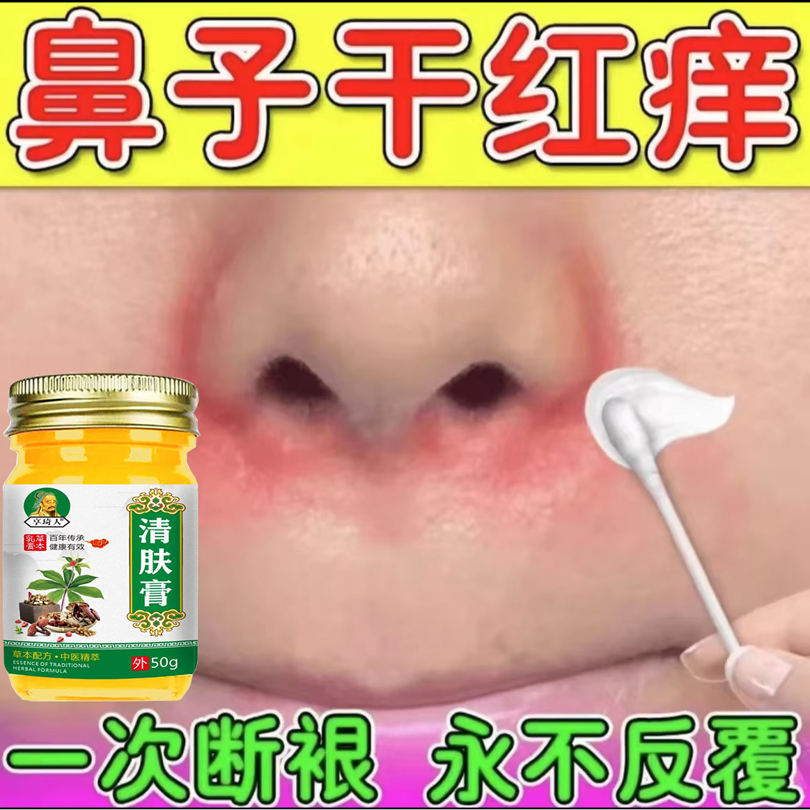 鼻翼两侧发红脱皮脱屑痒皮肤干燥起皮专用乳膏