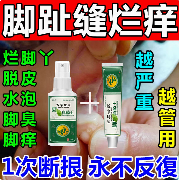 脚趾缝痒专用脚痒脚臭止痒神器脚丫脱皮抑菌膏开裂克星喷雾剂
