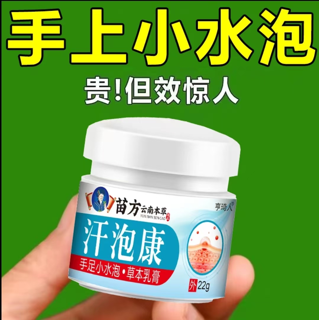 手指痒起小水泡痒止痒膏脱皮干裂手掌开裂克星抑菌乳膏专用正品