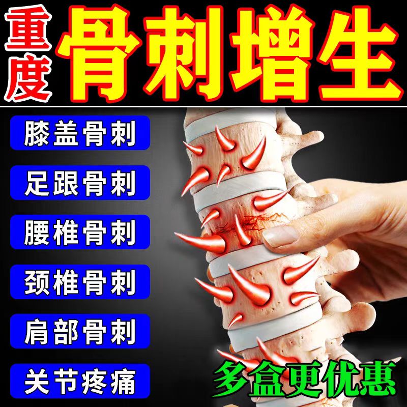 【骨质增生骨刺膏】足跟膝盖疼痛腰疼腿疼脚后跟足跟疼痛穿龙骨刺膏