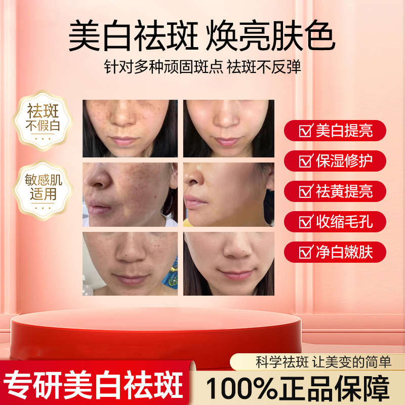 大大（拍一发二）LMS221祛1班1液精华美白新款2024白白