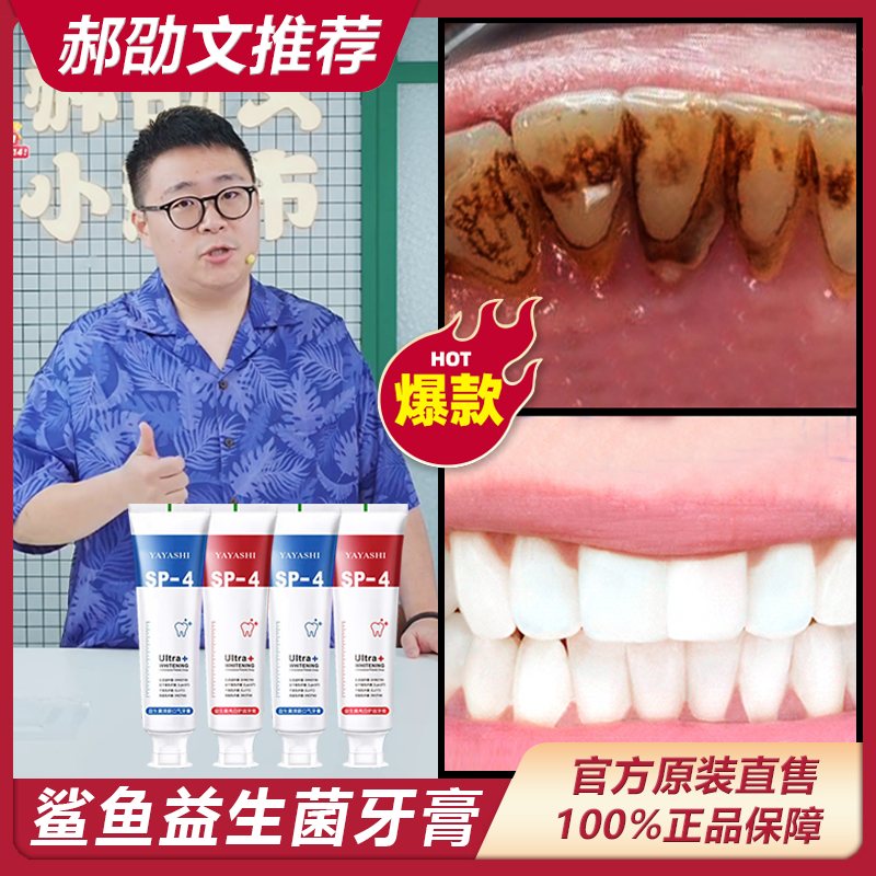 【郝邵文推荐】雅牙仕SP-4鲨鱼原装牙膏亮白去黄清新口腔护龈健齿