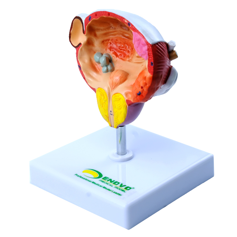 ENOVO颐诺 人体膀胱前列腺/疾病演示模型男性泌尿外科医患沟通男