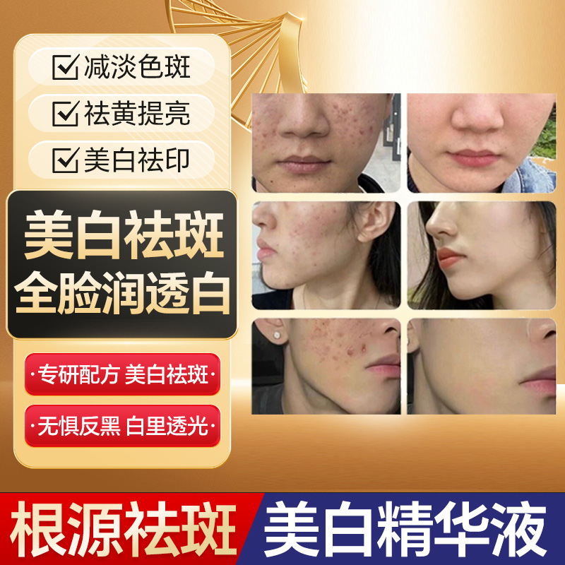 【拍一发二】ss699国妆祛1斑1液美白新品黑色素点斑修护淡斑霜遮