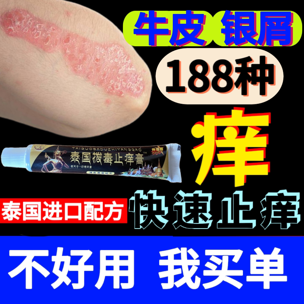 泰国配方植物萃取抑菌草本乳膏止痒银屑痒清大腿内侧瘙痒干燥润肤