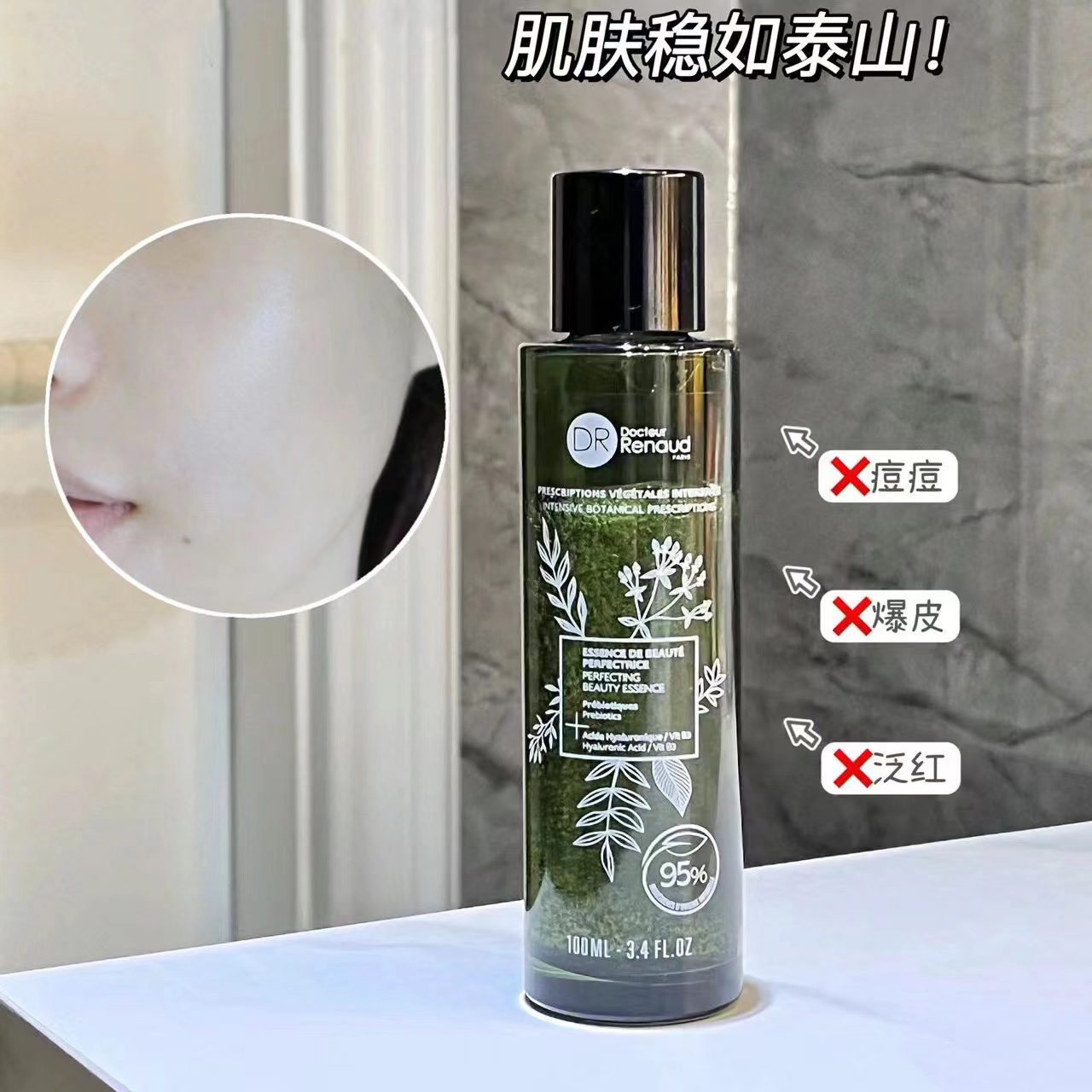【抗初老精粹水！】红敏痘皮冲！源348元！法国益生元精华水