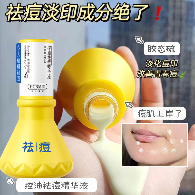 祛痘大灯泡精华液快速瘪痘去闭口粉刺淡痘印褪红舒缓控油保湿补水