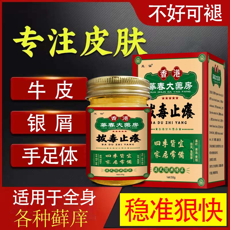 全身顽固牛皮干痒牛皮银屑快速止痒膏外用涂抹膏草本抑菌护理止痒