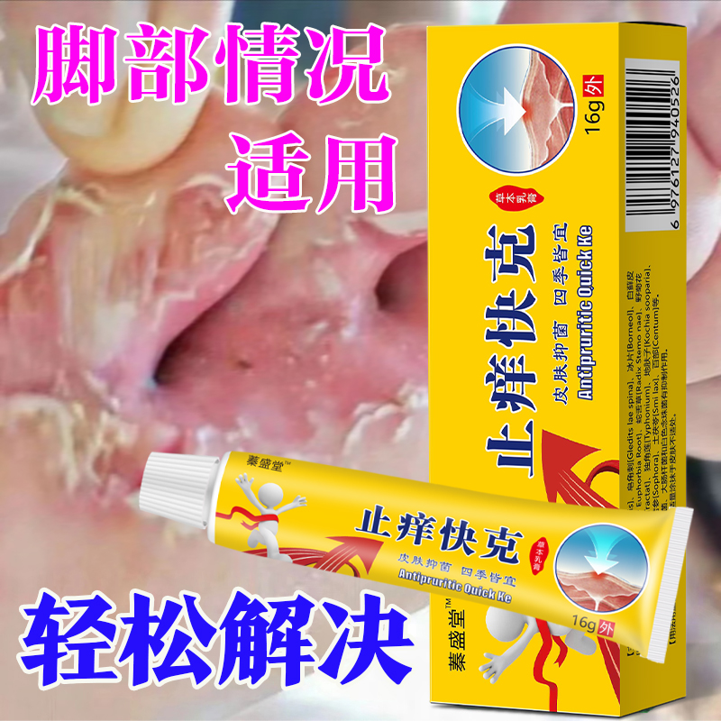 脚底脱皮脚趾缝痒拦脚丫脚痒脚臭草本抑菌清凉止痒乳膏