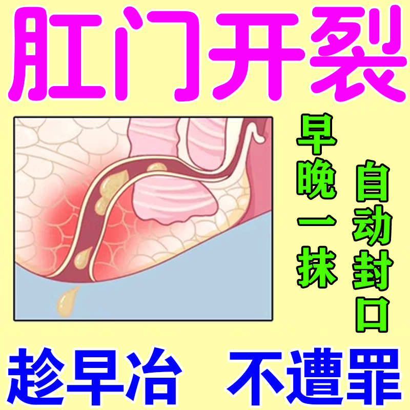肛门裂口修覆复膏屁眼裂口肛门破肛周围脓肿硬块大便流血开裂膏
