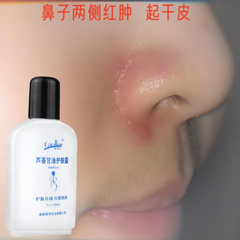 鼻子干燥起皮脱皮脸部皮肤干燥掉皮屑痒润肤秋冬季学生芦荟甘油露