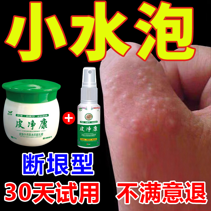 手指痒起小水泡净清汗状皮肤瘙痒专用止痒膏喷雾抑菌克星软膏正品