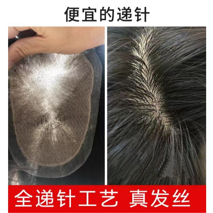 便宜递针德国沙男士假发头大补发真发补发块前额发际线无痕生物皮