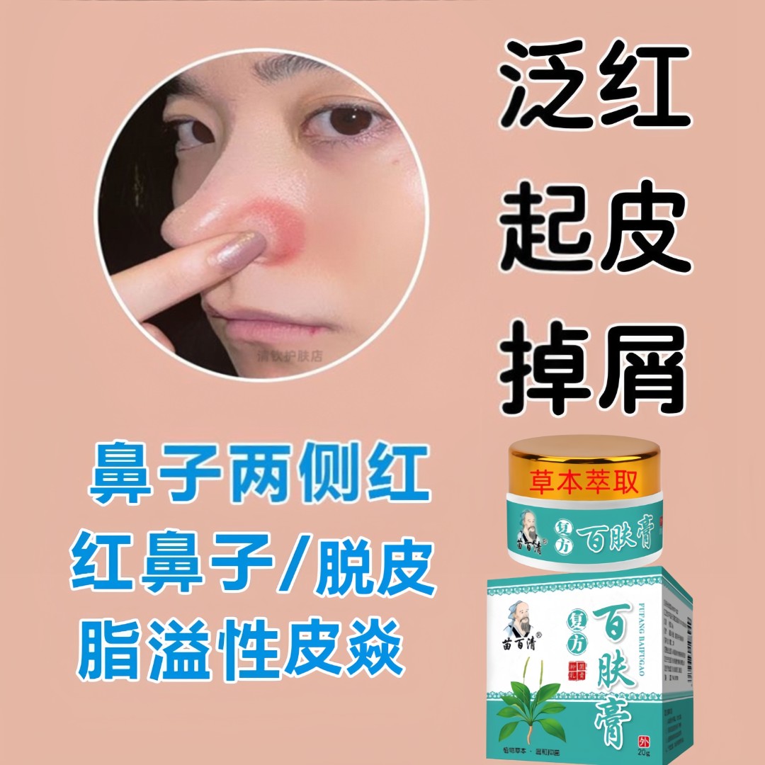 酒糟鼻【红鼻头涂抹膏】男女通用鼻子红草莓鼻鼻头黑头草本苗百清膏