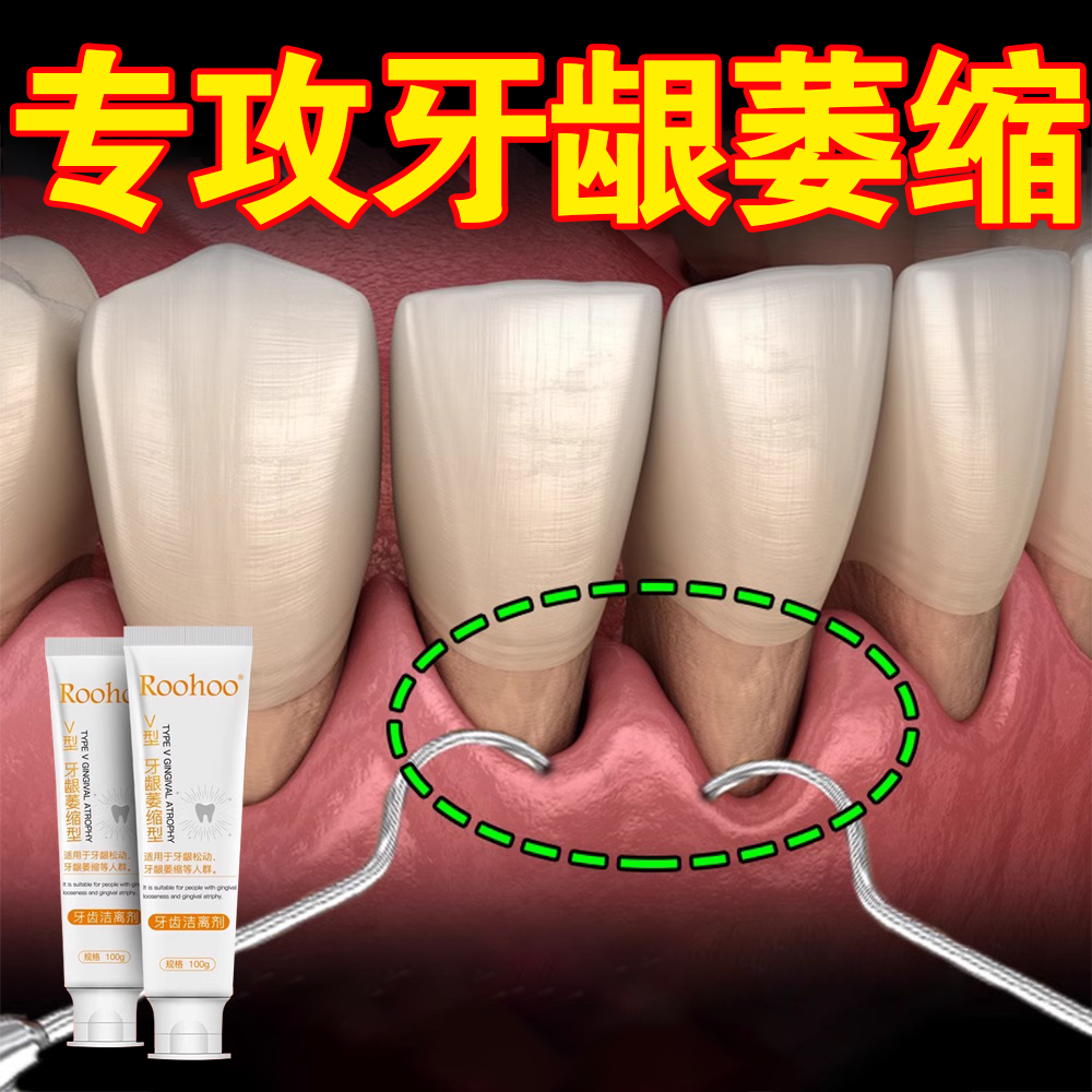 roohoo牙齿洁离剂牙龈萎缩型牙龈松动适用