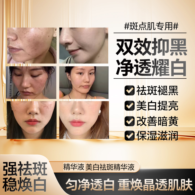 贝贝（拍一发二）ML6647白白祛1班1液美白新品精华2023