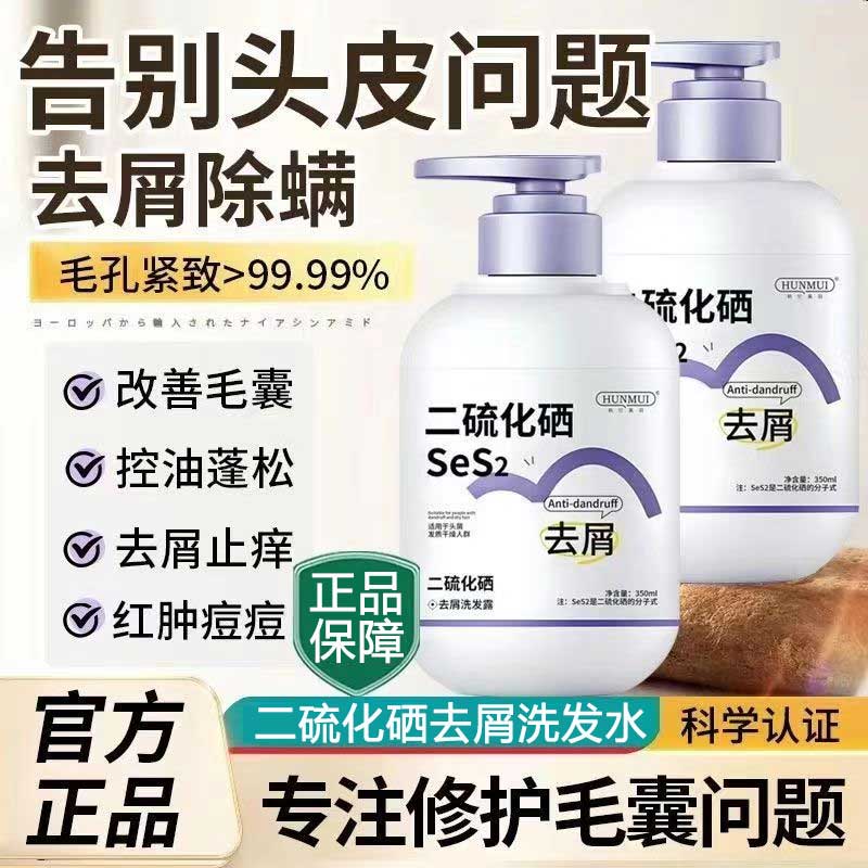 【去屑止痒控油】二硫化硒洗发露去屑止痒控油蓬松洗发水除螨洗头