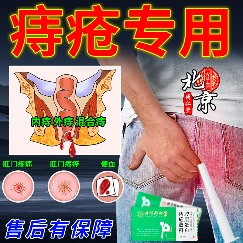北京同仁堂痔疮膏内痔外痔混合痔肛门肿胀疼痛内廷上用胶原蛋白痔疮敷料