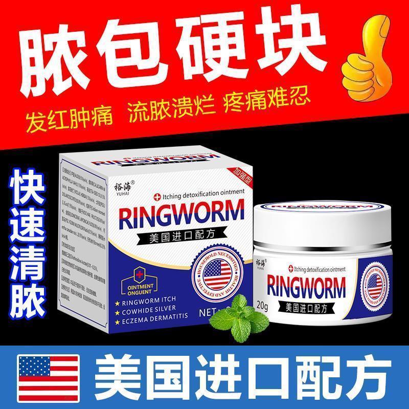 【不好包褪】火疖子拔毒进口火疙瘩屁股硬块坐板疮外用涂抹身体护