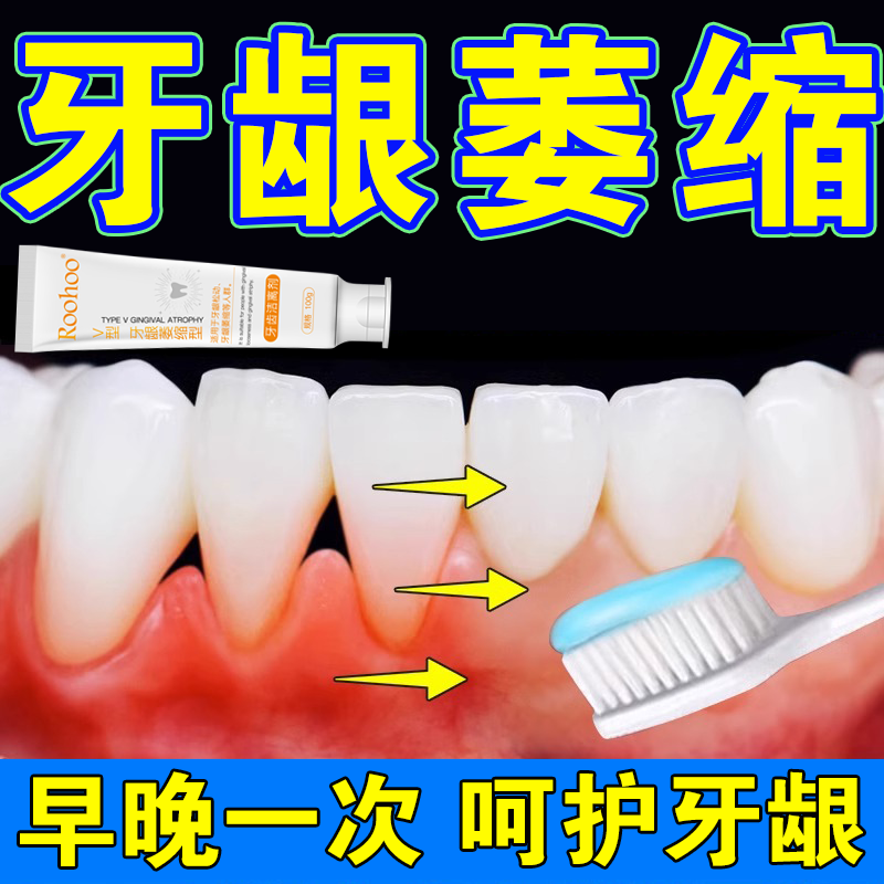 roohoo牙龈萎缩型牙齿洁离剂牙龈松动适用凝胶牙齿清洁分离型