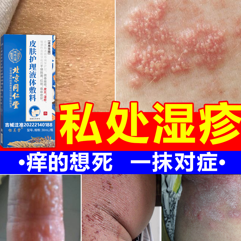 内廷上用男人下面痒阴囊潮湿湿疹丘疹私处瘙痒皮肤护理液体敷料