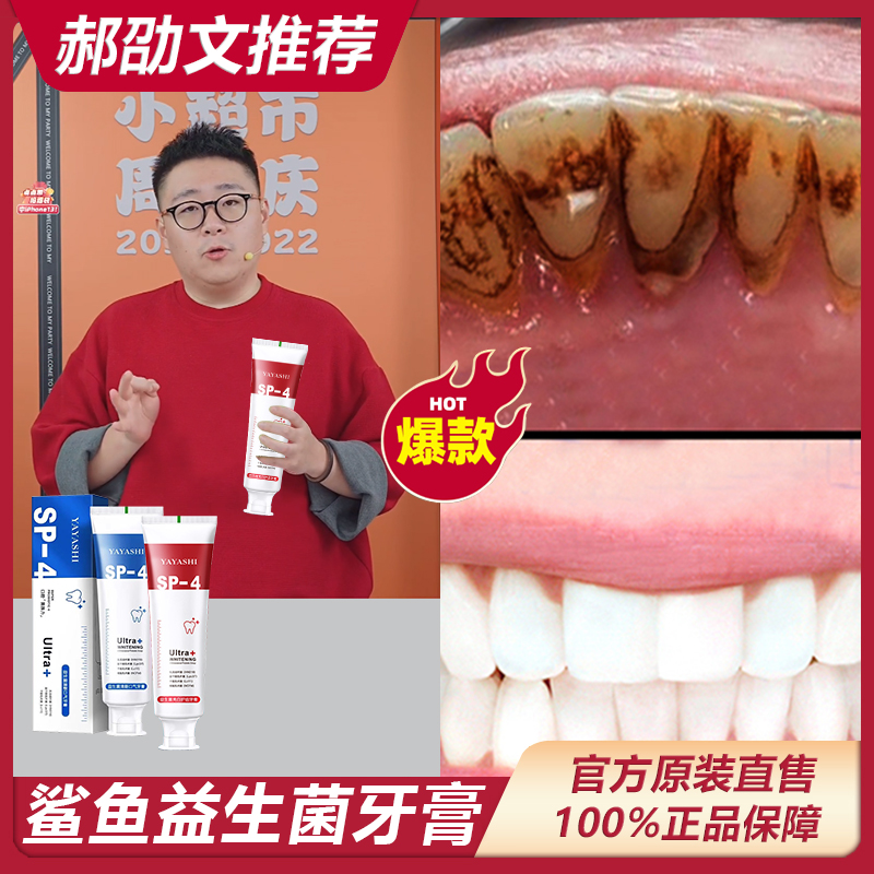 主播专属 雅牙仕SP-4酵素牙膏清新炫白洁牙护龈清新怡人温和淡*