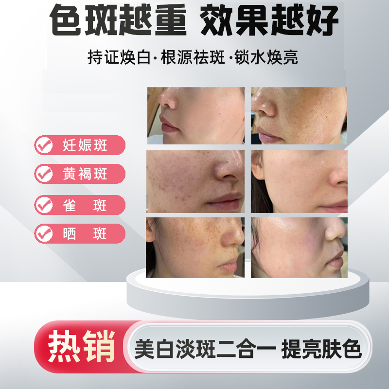 品品（拍一发二）CJ9FFF祛1班1液美白精华2024新品