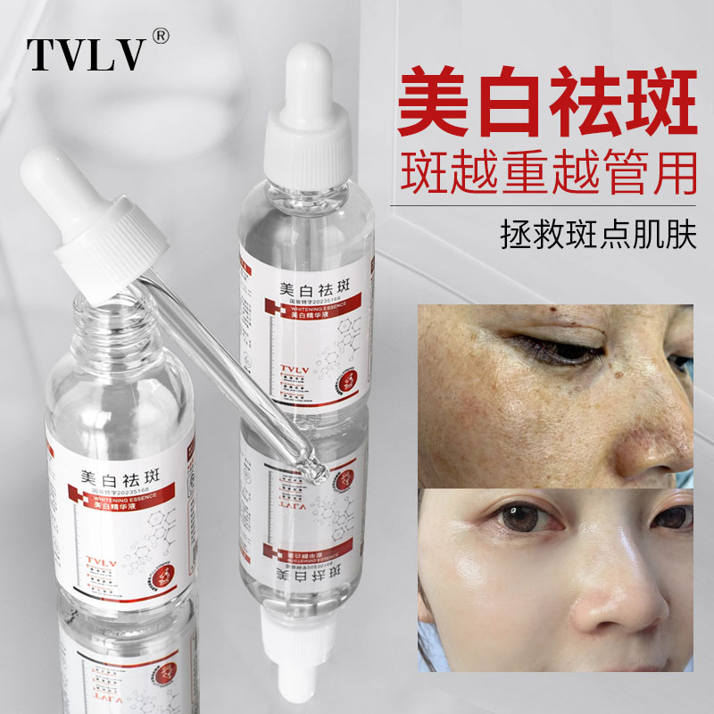 快速淡斑美白老年斑色斑/黄褐斑/雀斑越严重越管用/美白精华液