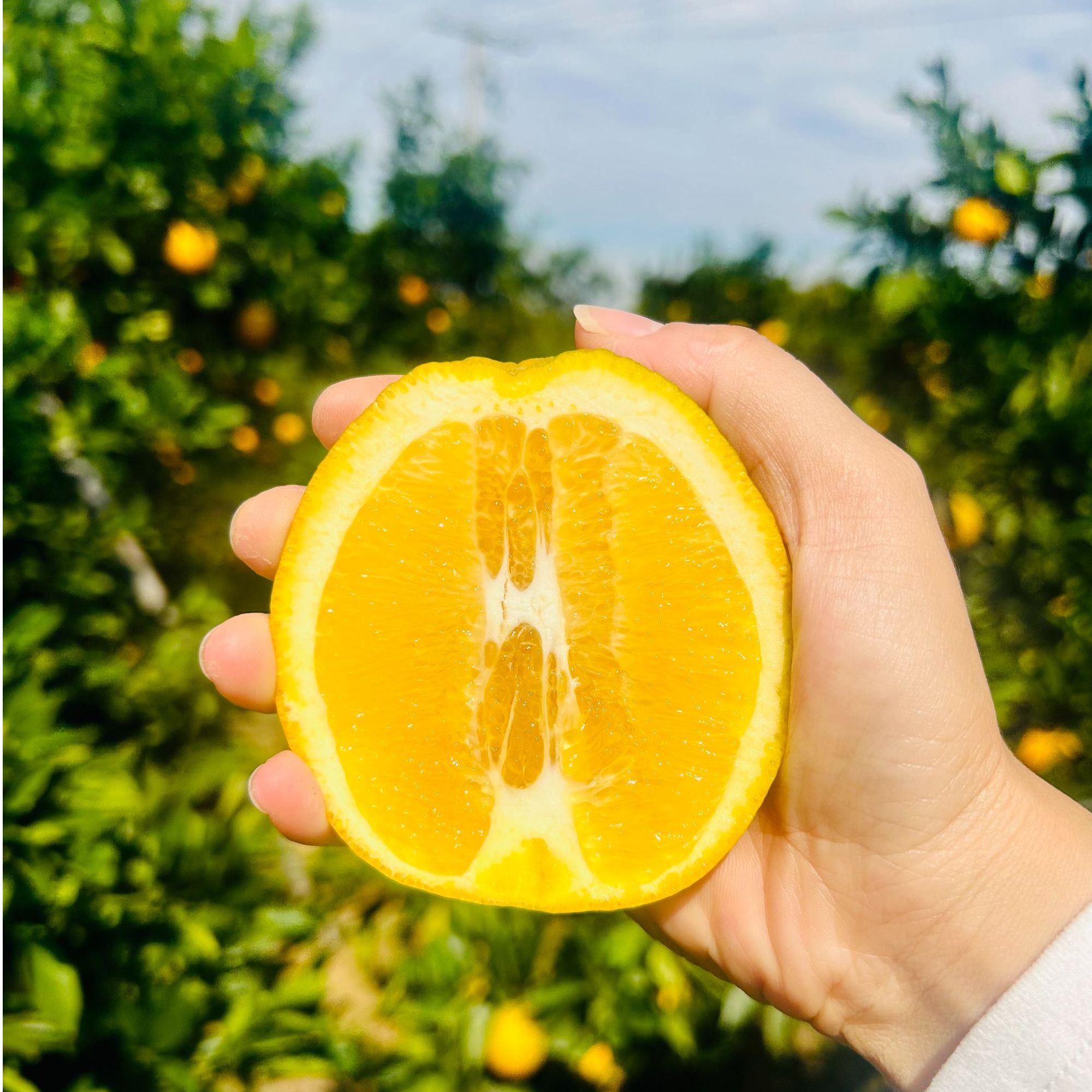 【水果】湖北松滋新鲜脐橙产地现摘现发多汁酸甜可口包邮